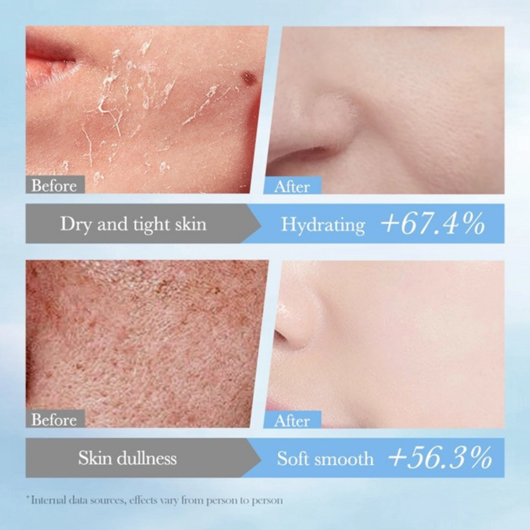Hydrating Moisturising Facial Mask