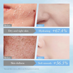Hydrating Moisturising Facial Mask